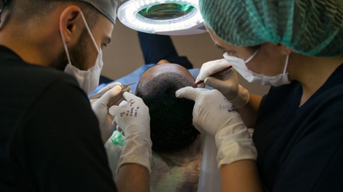 Conhecendo o mercado de Transplante Capilar FUE / FUT
